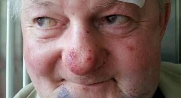 Former Kerryman sports journalist, Eamon Horan, pictured in the aftermath of the cowardly attack